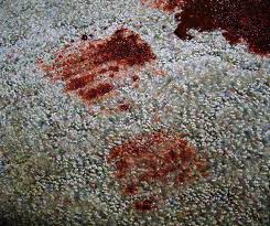 And my lawyers advise me not to go into it.